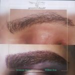 کلینیک تخصصی کاشت مو و ابرو یاسمین در سپاهانشهر اصفهان