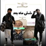کلینیک تخصصی کاشت مو و ابرو یاسمین در سپاهانشهر اصفهان