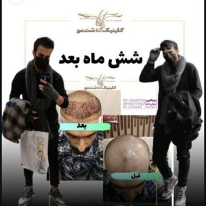 مشاهده کلینیک تخصصی کاشت مو و ابرو یاسمین در سپاهانشهر اصفهان در سامانه بهبود مشاغل