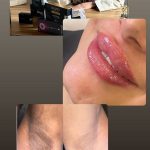 کلینیک زیبایی و درمانی نازی در یحیوی اردبیل