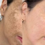 کلینیک زیبایی و درمانی نازی در یحیوی اردبیل