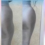کلینیک زیبایی و درمانی نازی در یحیوی اردبیل