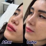 کلینیک زیبایی و لاغری الورا در ساری