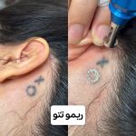 کلینیک زیبایی و لاغری الورا در ساری