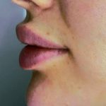 خدمات تخصصی فیلر و بوتاکس فریبا میرزایی در هشت بهشت اصفهان