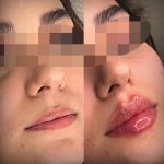 خدمات تخصصی ژل و بوتاکس نازنین سالاری در بندرعباس