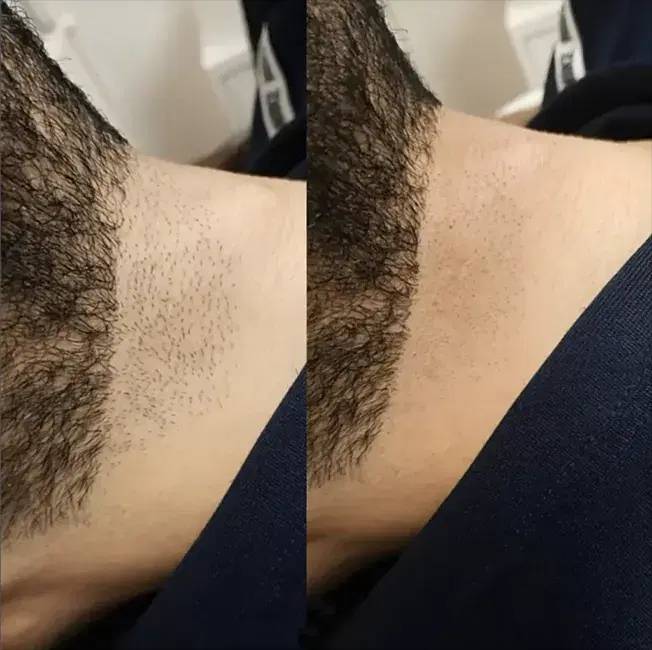 مشاهده آگهی کلینیک تخصصی لیزر مو زائد غزل در ایذه در سامانه بهبود مشاغل