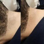 کلینیک تخصصی لیزر مو زائد غزل در ایذه