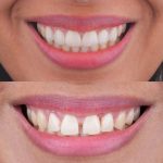 مطب تخصصی دندانپزشکی دکتر زینب طالعی در بندرعباس