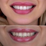 مطب تخصصی دندانپزشکی دکتر زینب طالعی در بندرعباس