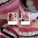 مطب تخصصی دندانپزشکی دکتر زینب طالعی در بندرعباس