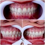 مطب تخصصی دندانپزشکی دکتر زینب طالعی در بندرعباس
