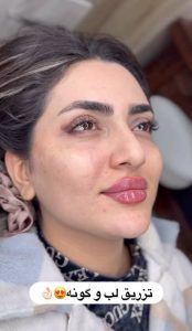 مشاهده کلینیک زیبایی نور در چهارراه گلستان کرمانشاه در سامانه بهبود مشاغل