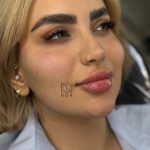 کلینیک زیبایی نور در چهارراه گلستان کرمانشاه