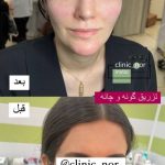 کلینیک زیبایی نور در چهارراه گلستان کرمانشاه