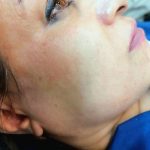 خدمات تخصصی فیلر و بوتاکس فریبا میرزایی در هشت بهشت اصفهان