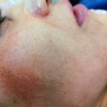 خدمات تخصصی فیلر و بوتاکس فریبا میرزایی در هشت بهشت اصفهان