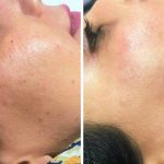 خدمات تخصصی فیلر و بوتاکس فریبا میرزایی در هشت بهشت اصفهان