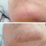 خدمات تخصصی فیلر و بوتاکس فریبا میرزایی در هشت بهشت اصفهان