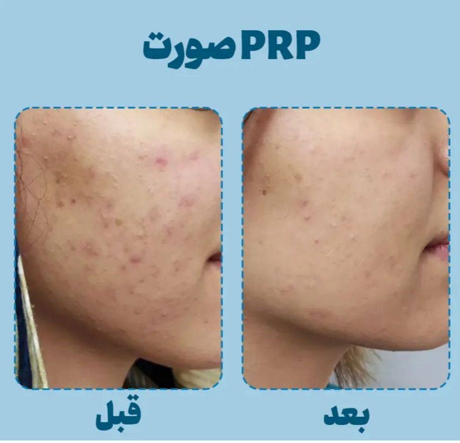 مشاهده آگهی سالن زیبایی یاس بیوتی در فاز 11 پردیس در سامانه بهبود مشاغل