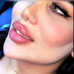 مشاهده خدمات تخصصی ژل و بوتاکس نازنین سالاری در بندرعباس در سامانه بهبود مشاغل