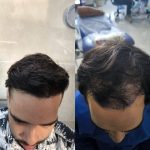 کلینیک تخصصی زیبایی و کاشت مو مدرن در قصر الدشت شیراز