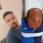 کلینیک تخصصی زیبایی و کاشت مو مدرن در قصر الدشت شیراز