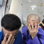 کلینیک تخصصی زیبایی و کاشت مو مدرن در قصر الدشت شیراز
