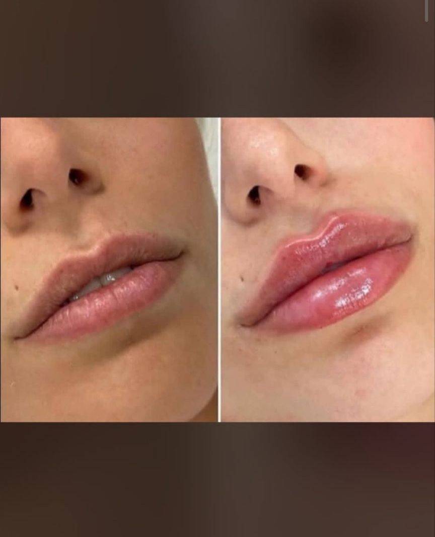 مشاهده آگهی کلینیک تخصصی زیبایی و کاشت مو مدرن در قصر الدشت شیراز در سامانه بهبود مشاغل