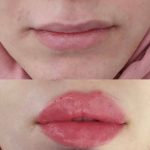 کلینیک تخصصی زیبایی و کاشت مو مدرن در قصر الدشت شیراز