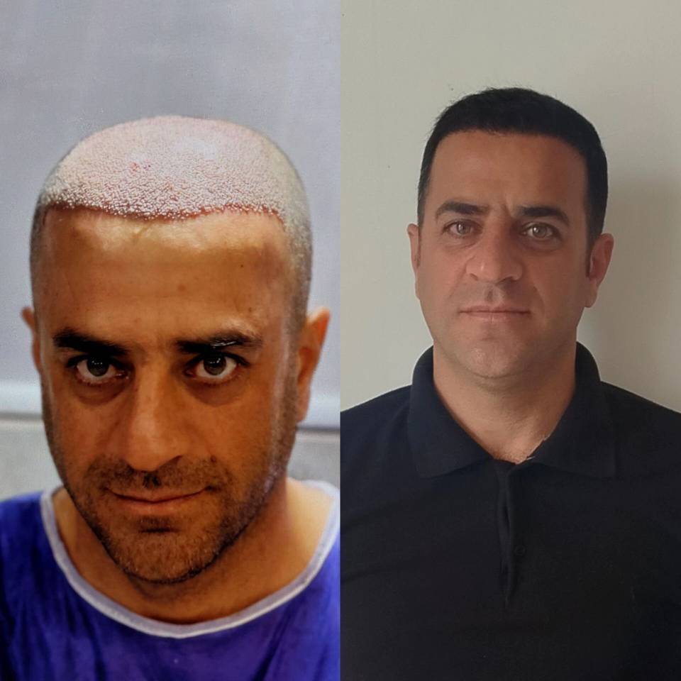 مشاهده آگهی مرکز کاشت مو آیدینی در ائل گلی تبریز در سامانه بهبود مشاغل