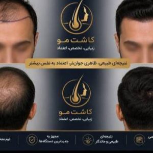 مشاهده آگهی مرکز کاشت مو آیدینی در ائل گلی تبریز در سامانه بهبود مشاغل