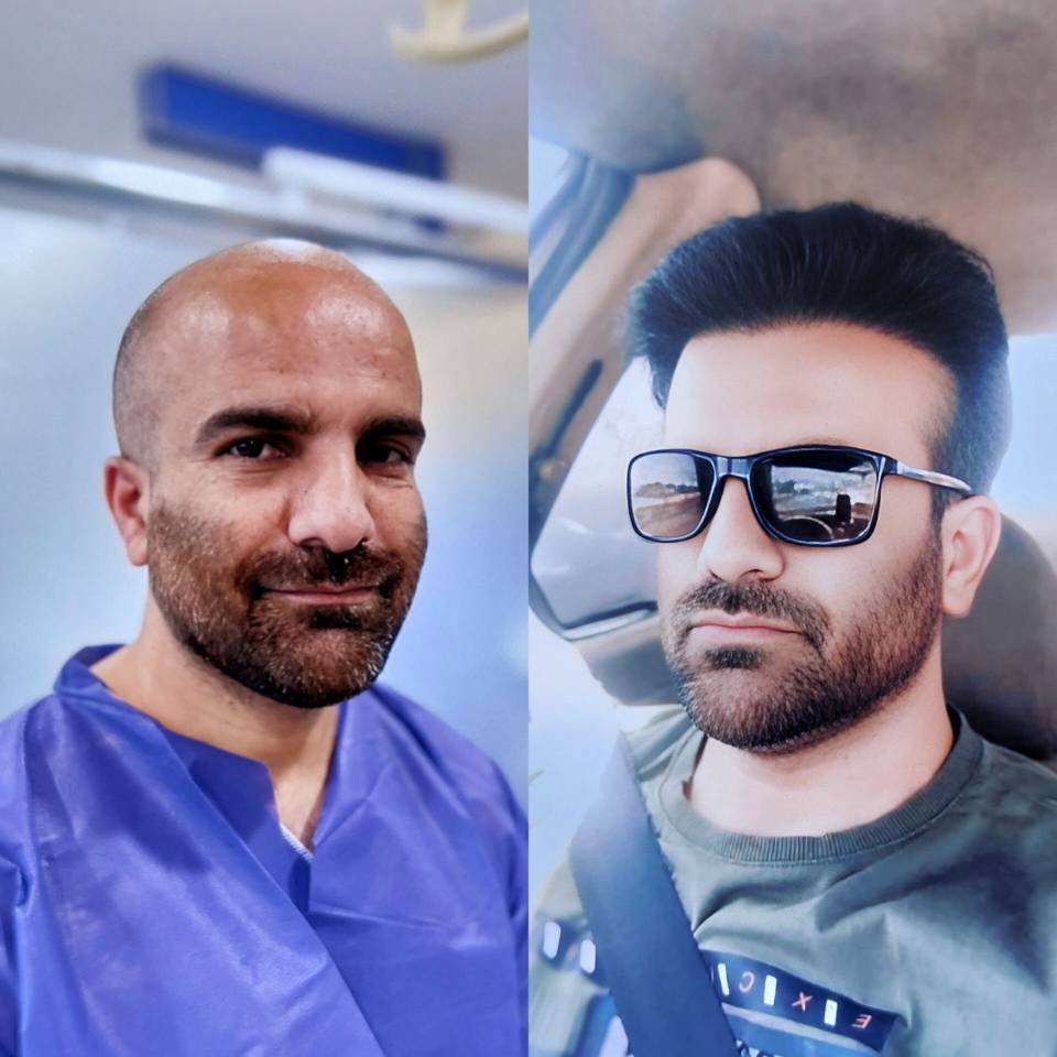 مشاهده آگهی مرکز کاشت مو آیدینی در ائل گلی تبریز در سامانه بهبود مشاغل