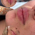 مرکز کاشت مو آیدینی در ائل گلی تبریز