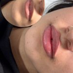 مرکز کاشت مو آیدینی در ائل گلی تبریز