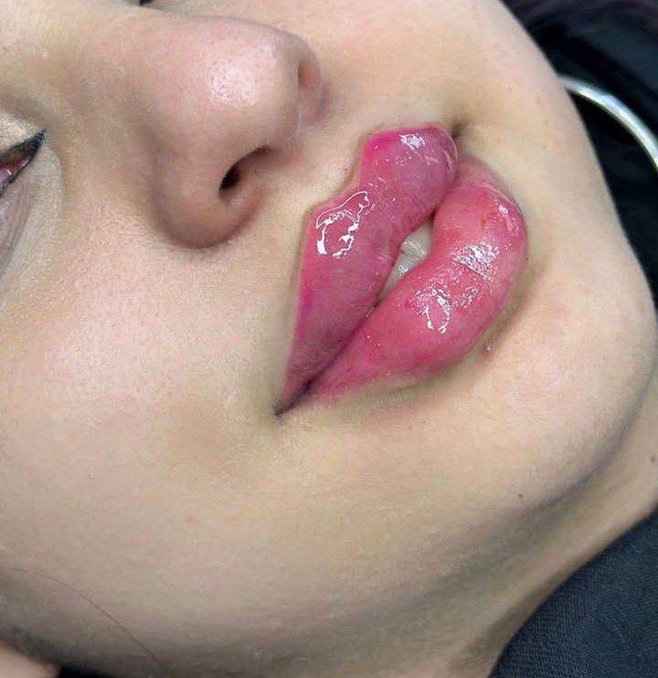 مشاهده آگهی مرکز کاشت مو آیدینی در ائل گلی تبریز در سامانه بهبود مشاغل