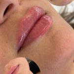 مرکز کاشت مو آیدینی در ائل گلی تبریز