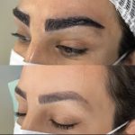 مرکز کاشت مو آیدینی در ائل گلی تبریز