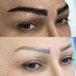 مرکز کاشت مو آیدینی در ائل گلی تبریز