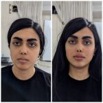 کلینیک ژل و بوتاکس مریم ذوالفقاری در کرج