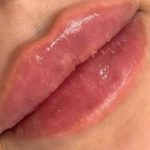 کلینیک ژل و بوتاکس مریم ذوالفقاری در کرج