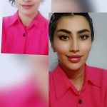 کلینیک ژل و بوتاکس مریم ذوالفقاری در کرج