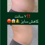 مرکز تخصصی لاغری ویراسنس در زعفرانیه تهران