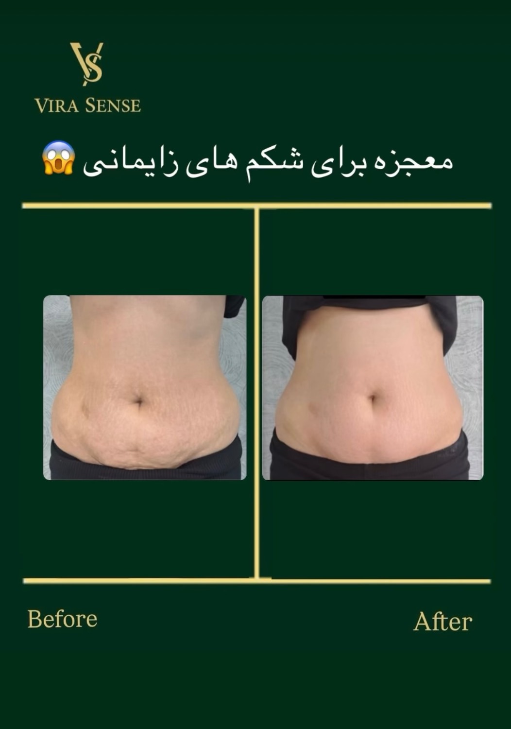 مشاهده آگهی مرکز تخصصی لاغری ویراسنس در زعفرانیه تهران در سامانه بهبود مشاغل