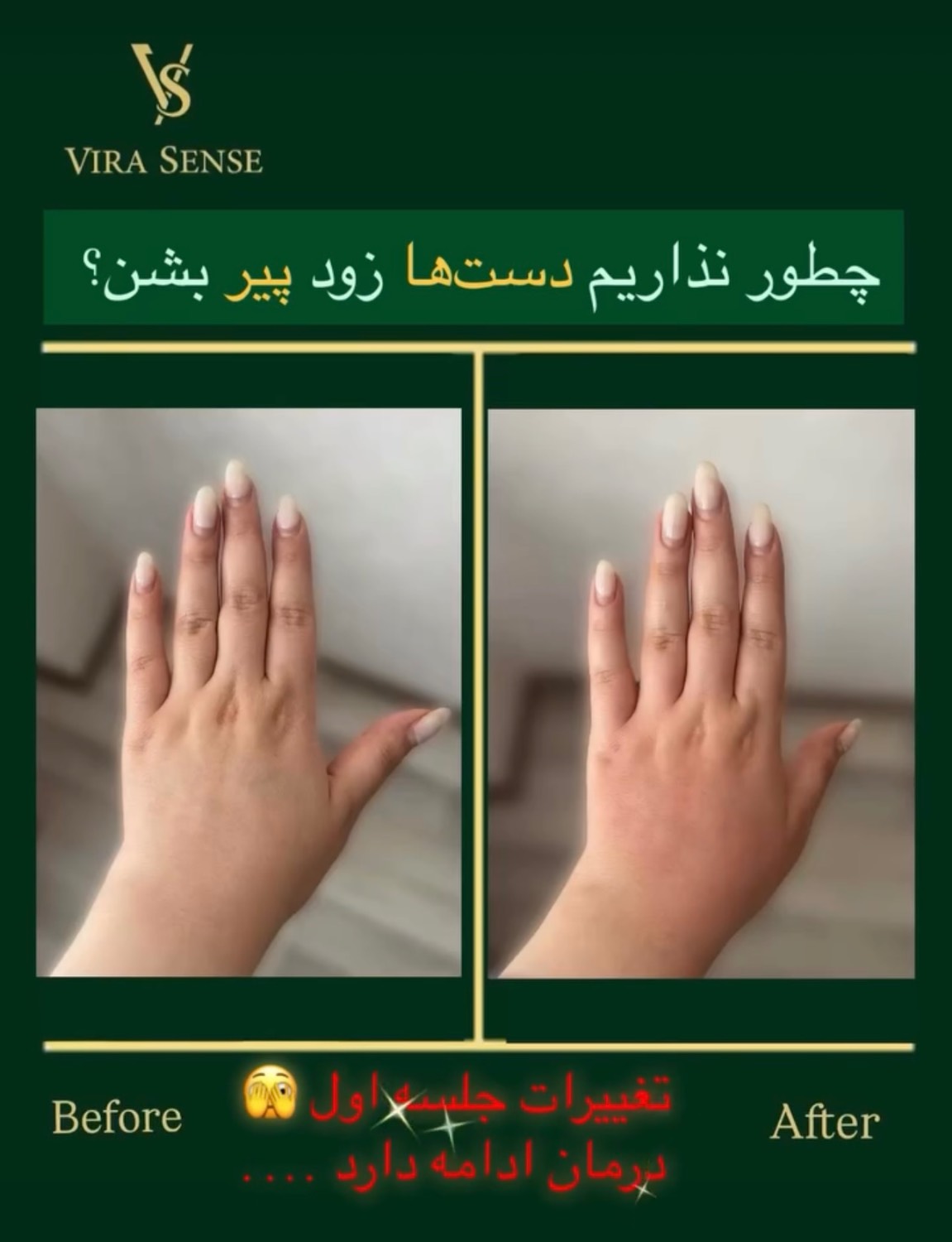 مشاهده آگهی مرکز تخصصی لاغری ویراسنس در زعفرانیه تهران در سامانه بهبود مشاغل