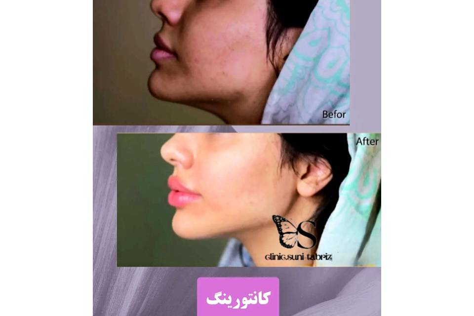 مشاهده آگهی کلینیک تخصصی زیبایی سانی در هفده شهریور تبریز در سامانه بهبود مشاغل