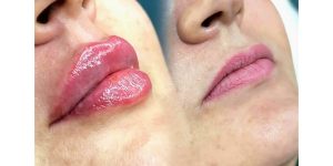 مشاهده خدمات تخصصی ژل و بوتاکس نازنین سالاری در بندرعباس در سامانه بهبود مشاغل