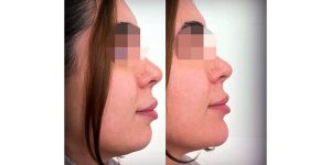 مشاهده خدمات تخصصی ژل و بوتاکس نازنین سالاری در بندرعباس در سامانه بهبود مشاغل