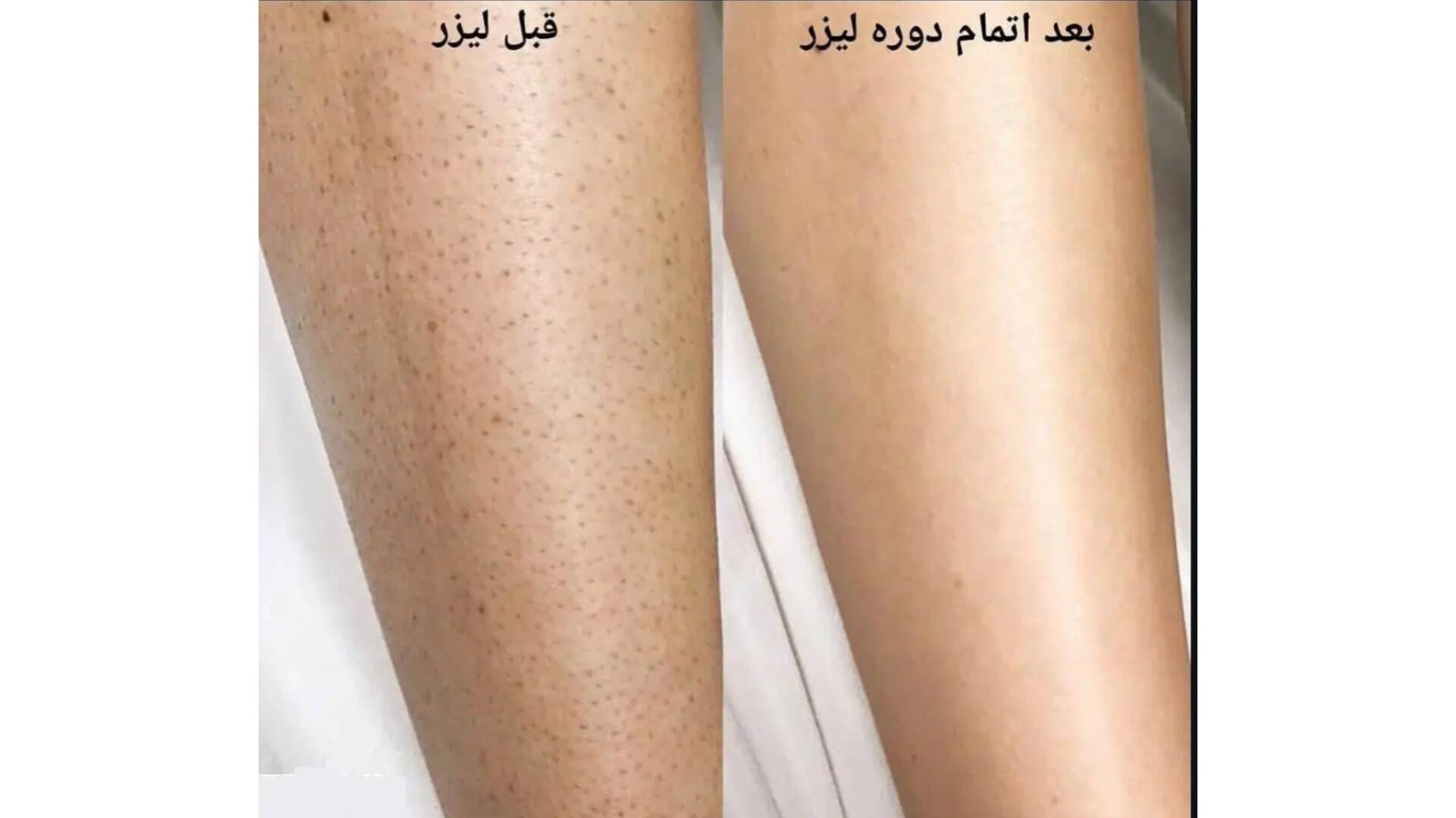 مشاهده آگهی کلینیک تخصصی لیزر مو زائد غزل در ایذه در سامانه بهبود مشاغل