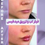 کلینیک تخصصی زیبایی سانی در هفده شهریور تبریز